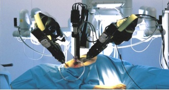 Tüp Mide Ameliyatında Robotik Cerrahinin Yeri Var mıdır?